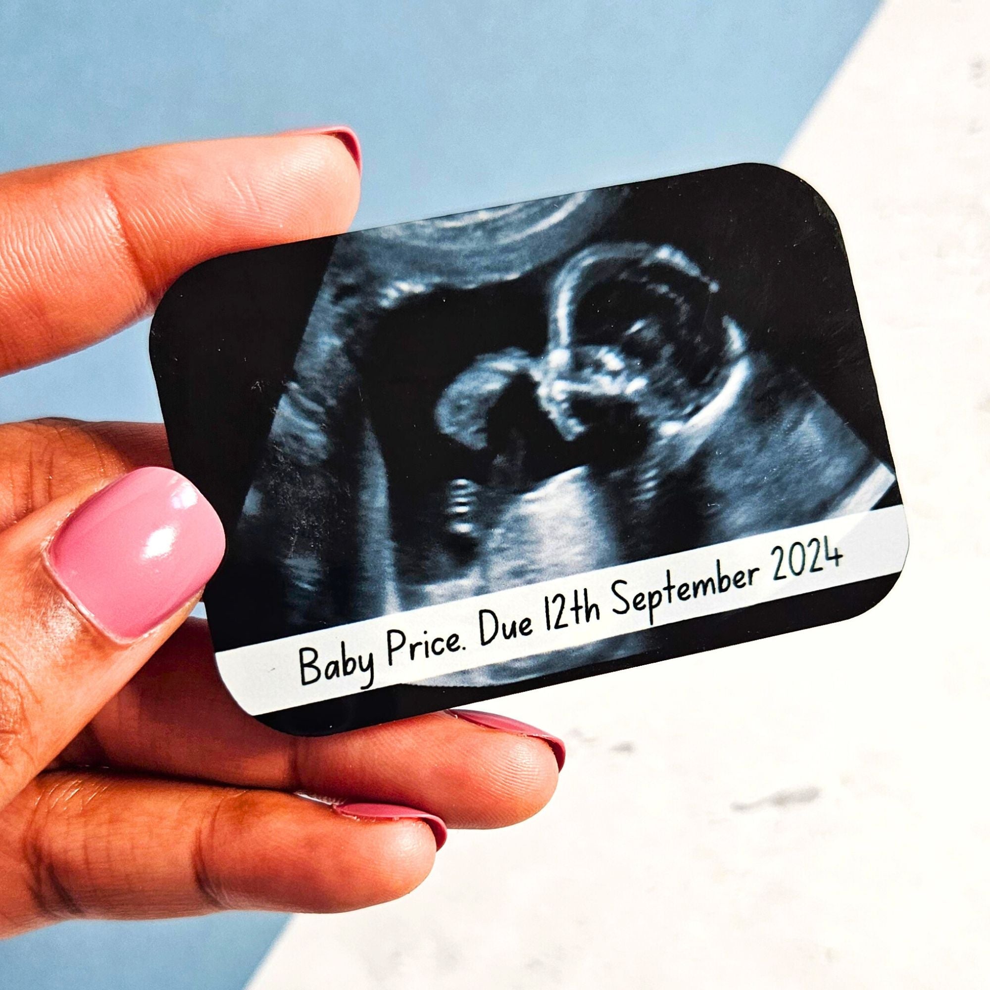 Personalised Baby Scan Ultrasound Photo Magnet